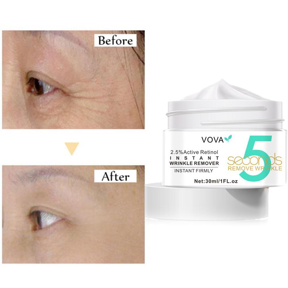 2.5% Active Retinol Eye Cream  - огляд і ціна Milk Thistle Silymarin